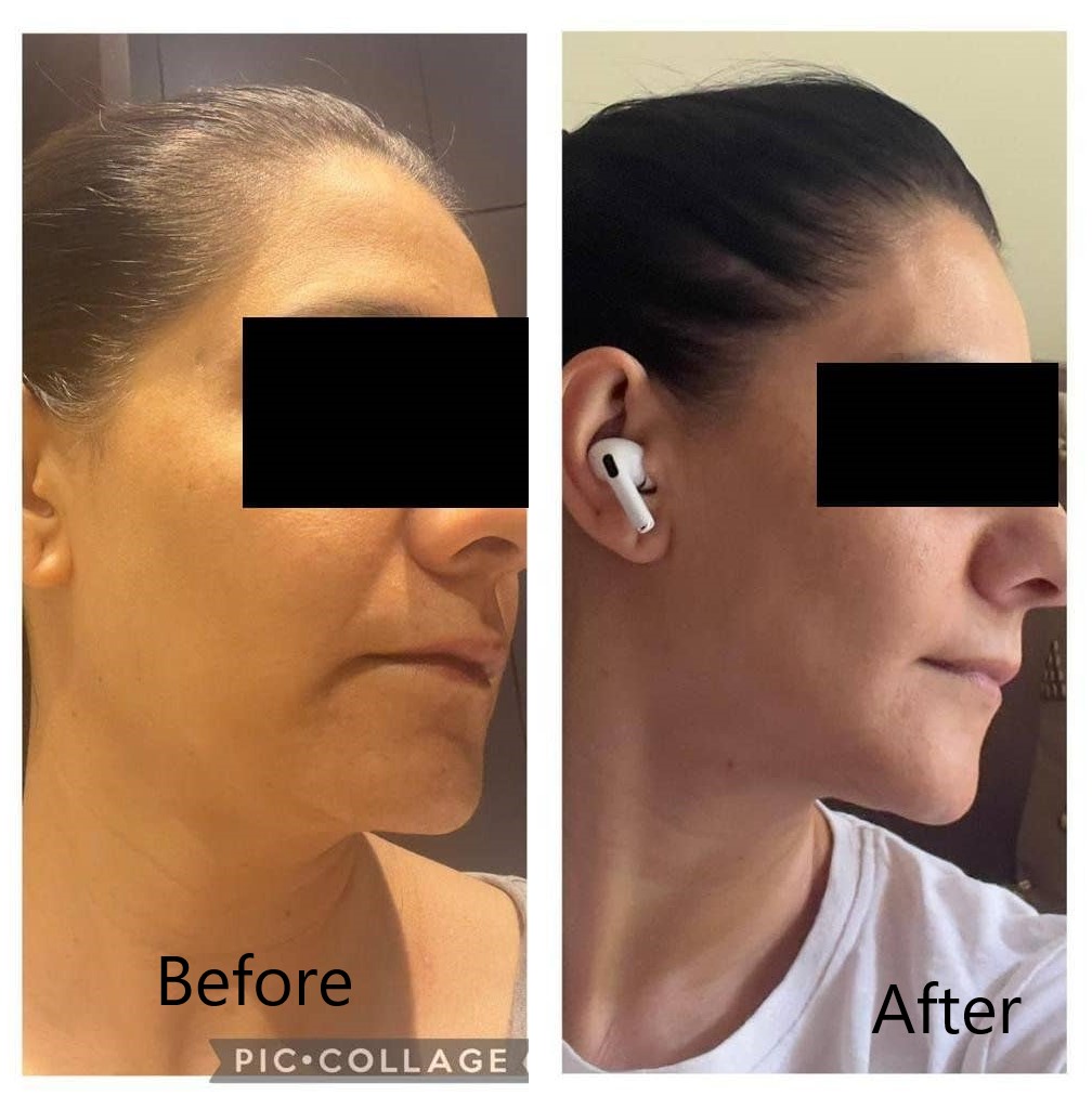 Skin Issue
